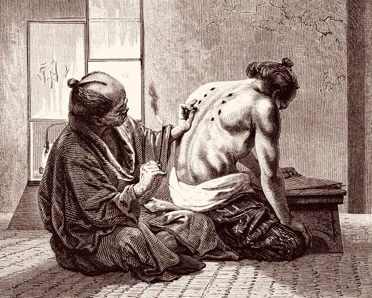 acupuncturist in Schaarbeek