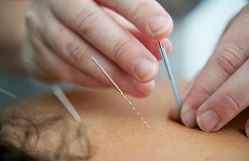 Acupuncturist in Brussels &ndash; Traditional Chinese Medicine in Schaerbeek