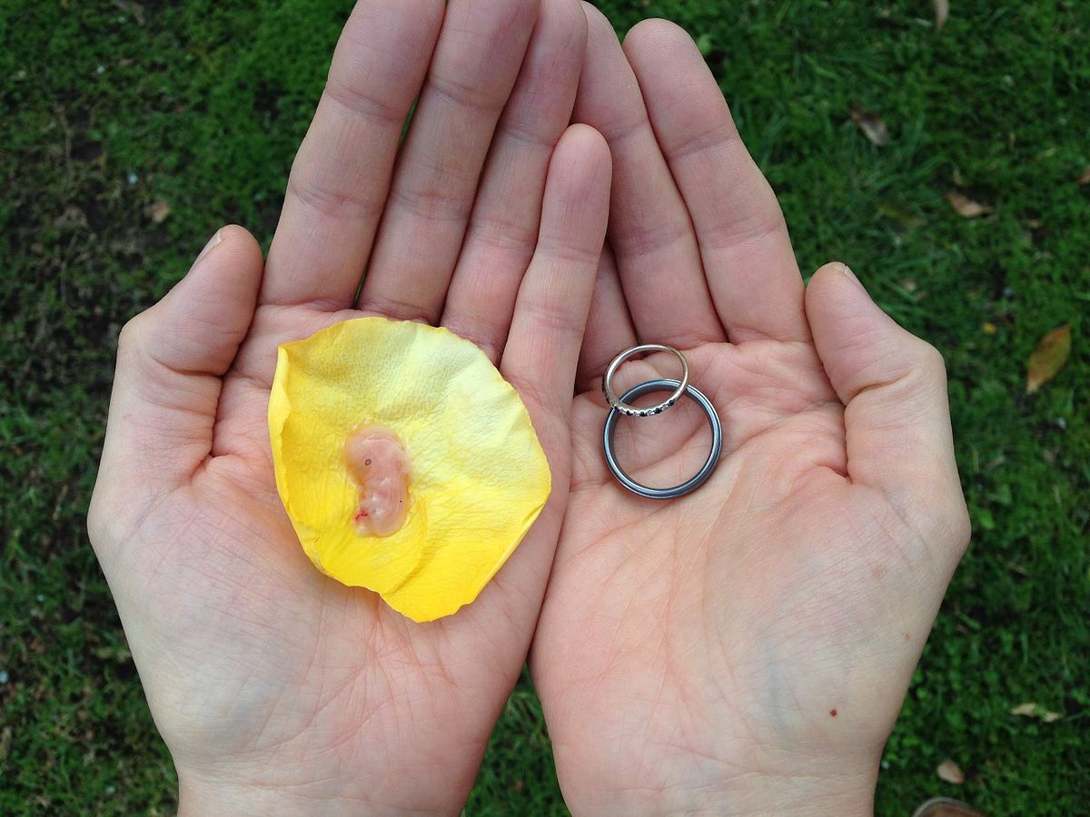 9-week old miscarried baby on a yellow rose petal next to his parents' wedding rings